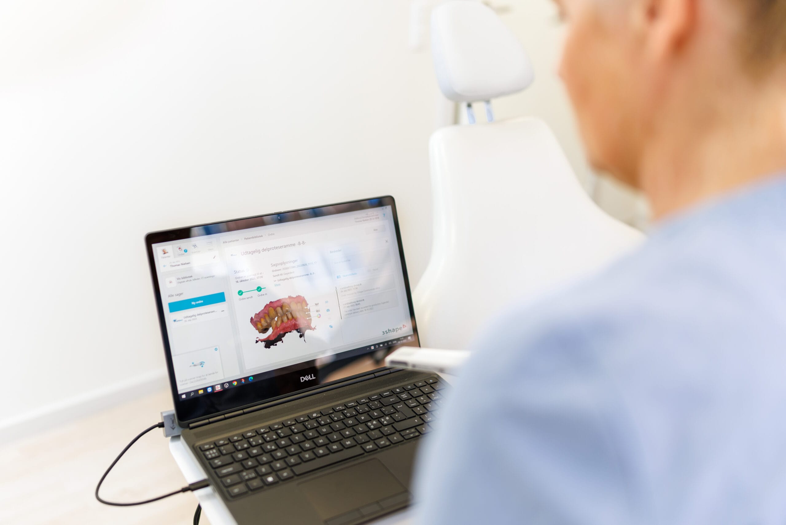 Tandlæge analyserer digital 3D scanning af tænder
